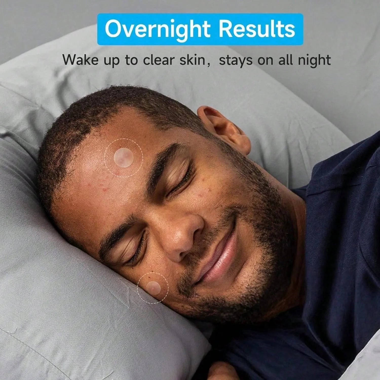 Toneur™ NightDart Pimple Patches