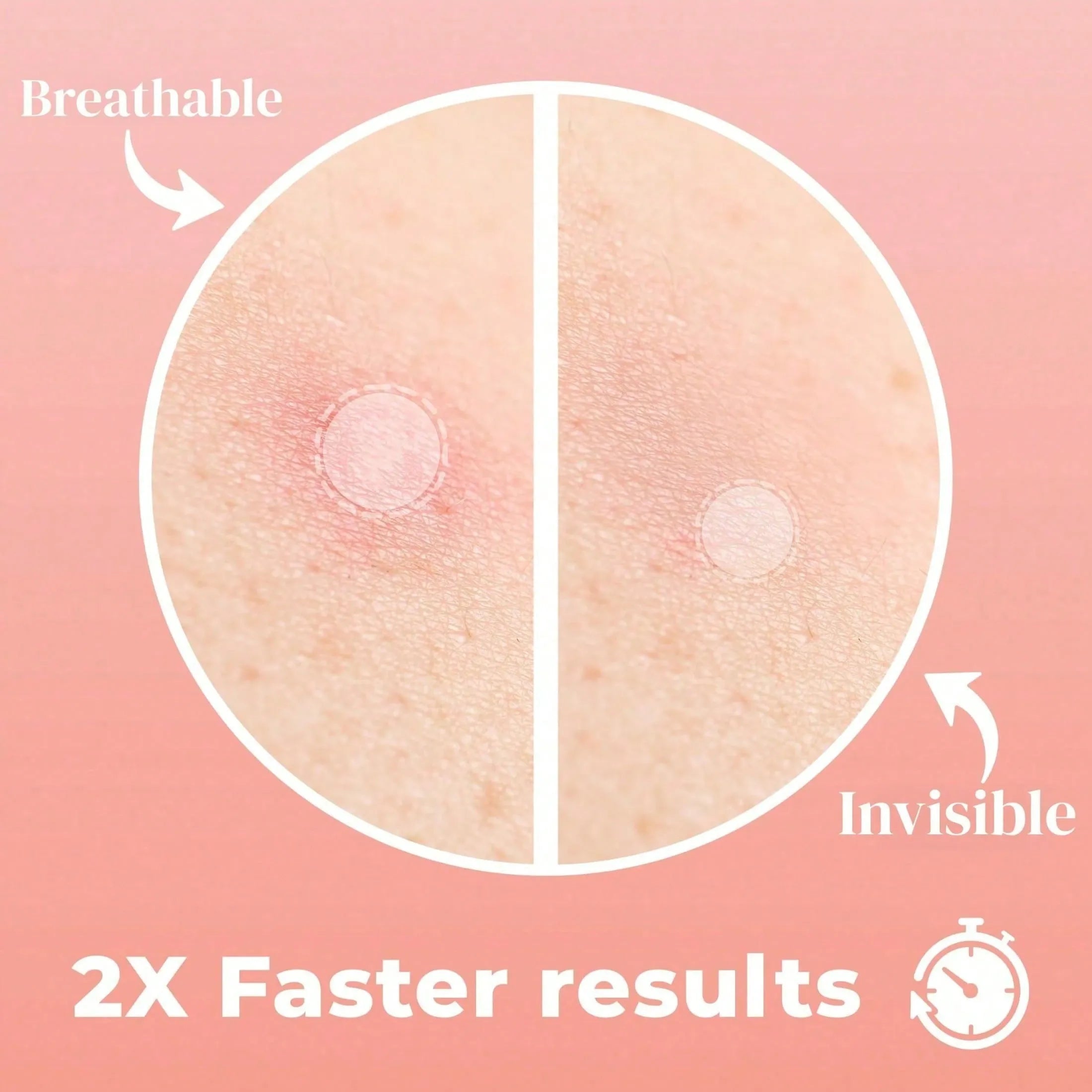 Toneur™ NightDart Pimple Patches