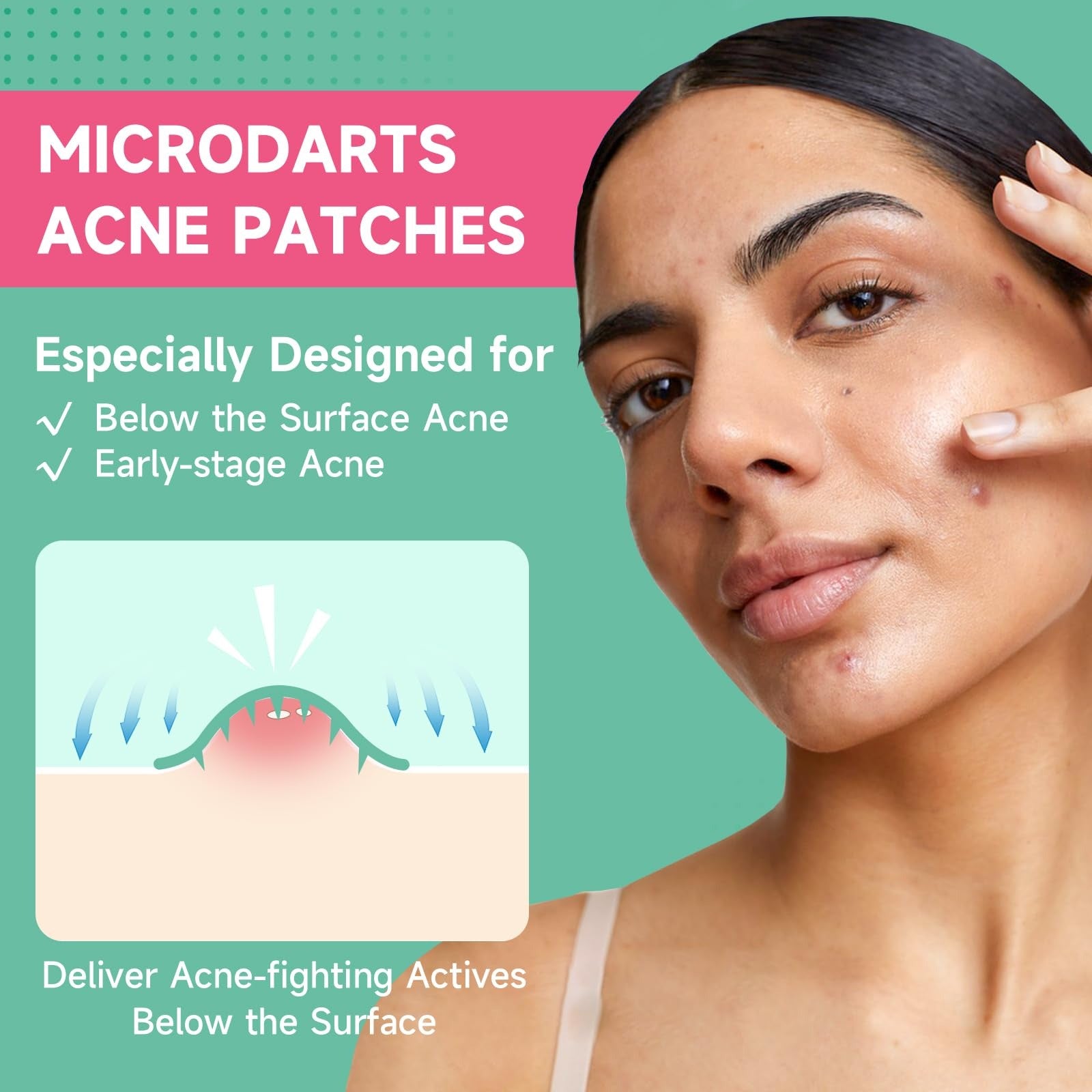 Toneur™ ClearDart Pimple Day Patches